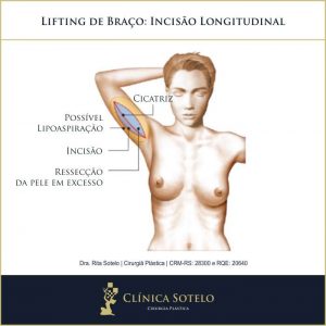 braquioplastia incisao cicatriz longitudinal